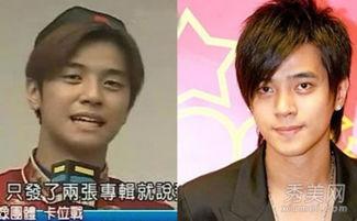 男明星都整容吗,男明星整容现象大揭秘